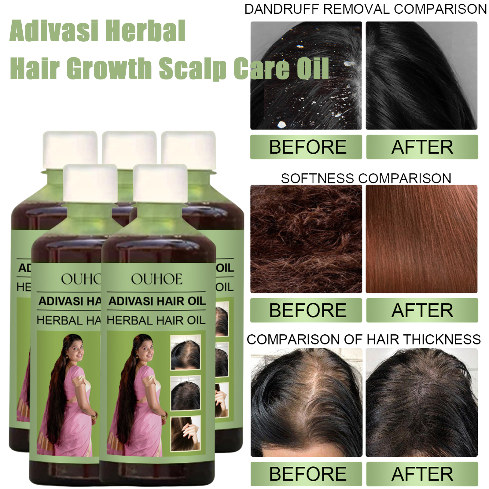 Hair Care Indian - 100ml Hair Growth Oil India Adivasi
