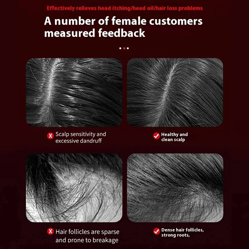 Electric Vibration Massage Com - đánh giá và giá Hair Care For Hair Growth