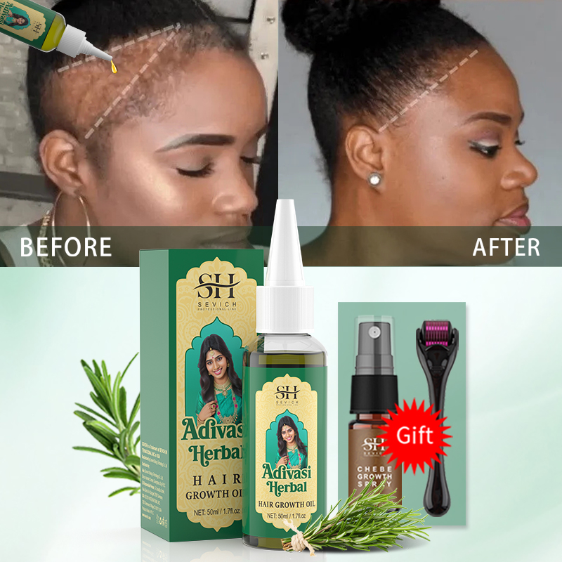 Ayurvedic Hair Growth Oil Indi - đánh giá và giá Hair Care Indian