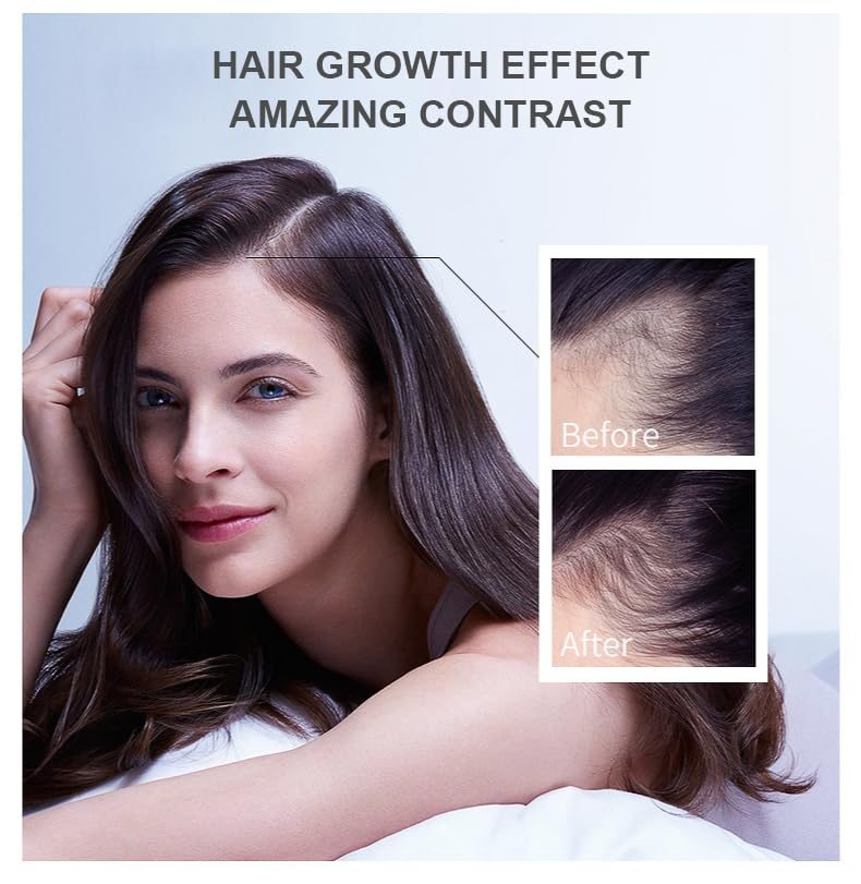 Hair Growth Oil Ginger Biotin  - đánh giá và giá Hair Care Essence Oil