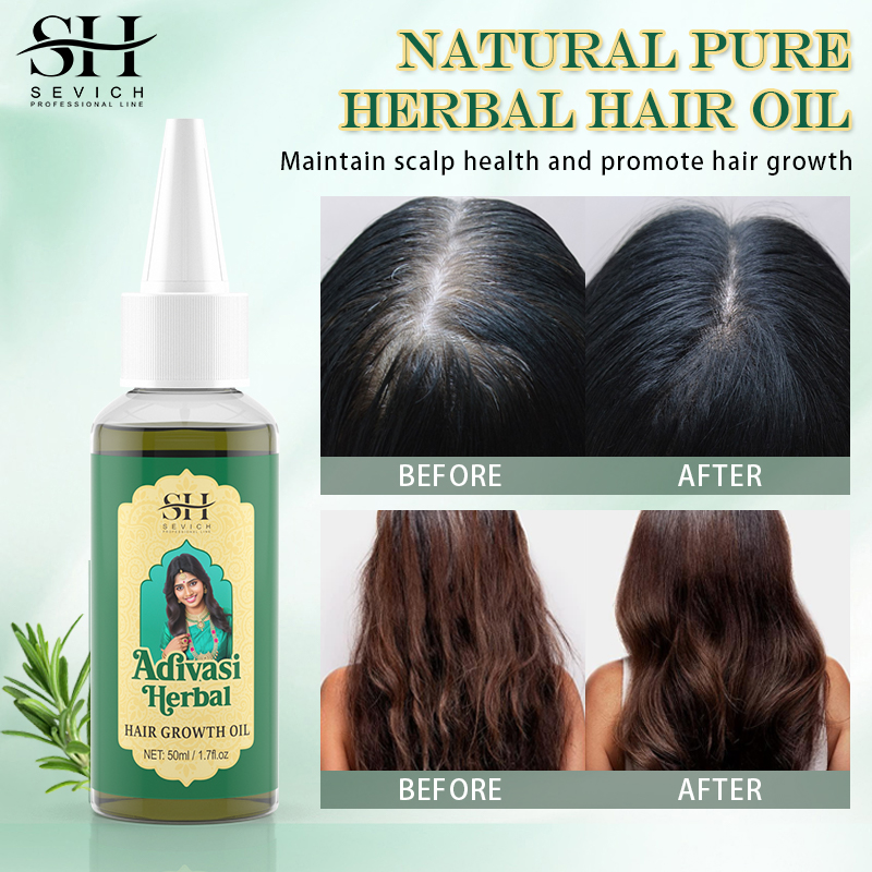 Ayurvedic Hair Growth Oil Adiv - đánh giá và giá Hair Care Indian