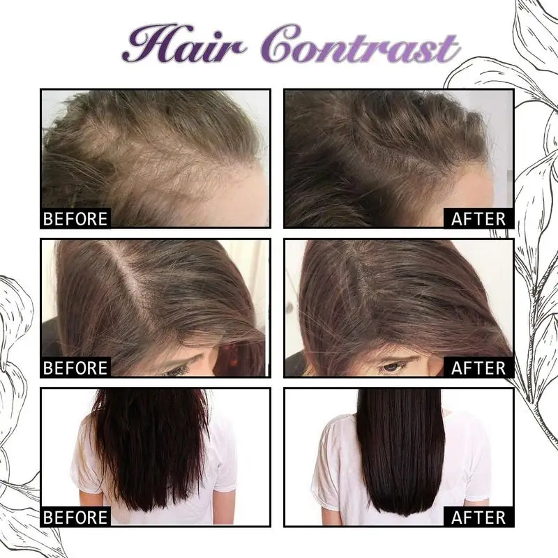 30ml Onion Rosemary Anti-Hair  - đánh giá và giá Hair Care Ordinary