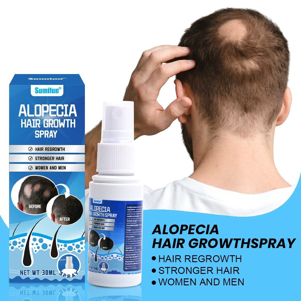 Alopecia Hair Growth Spray Sop - đánh giá và giá Hair Care For Hair Growth