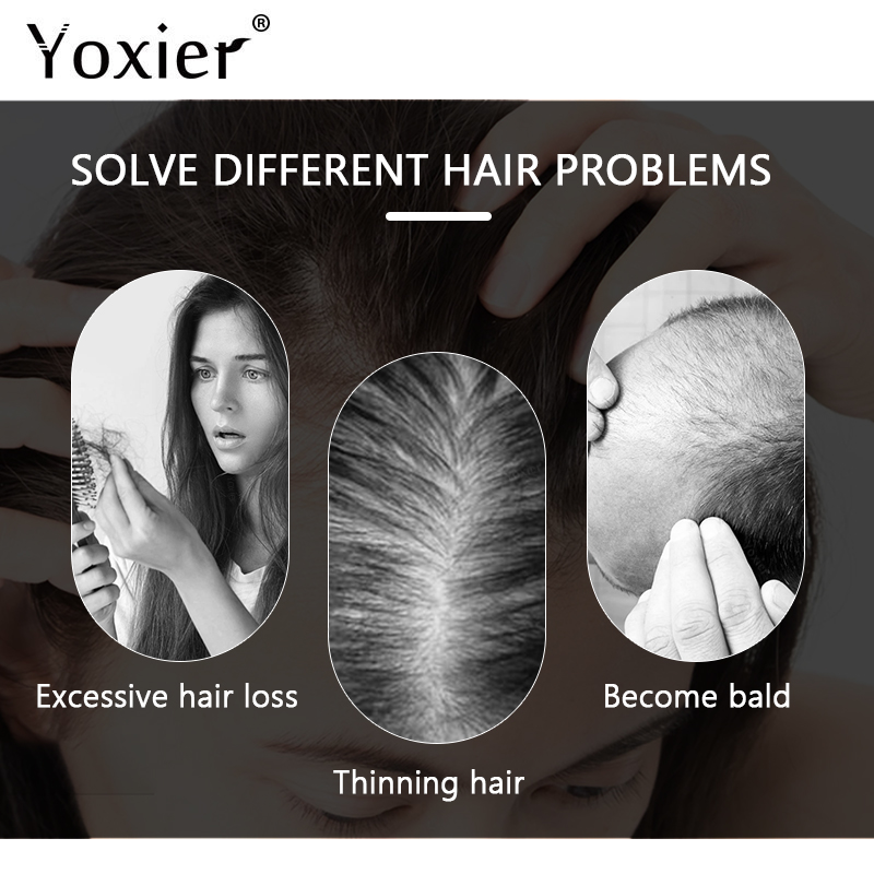 Intensive Growth Serum Prevent - đánh giá và giá Hair Care For Hair Growth