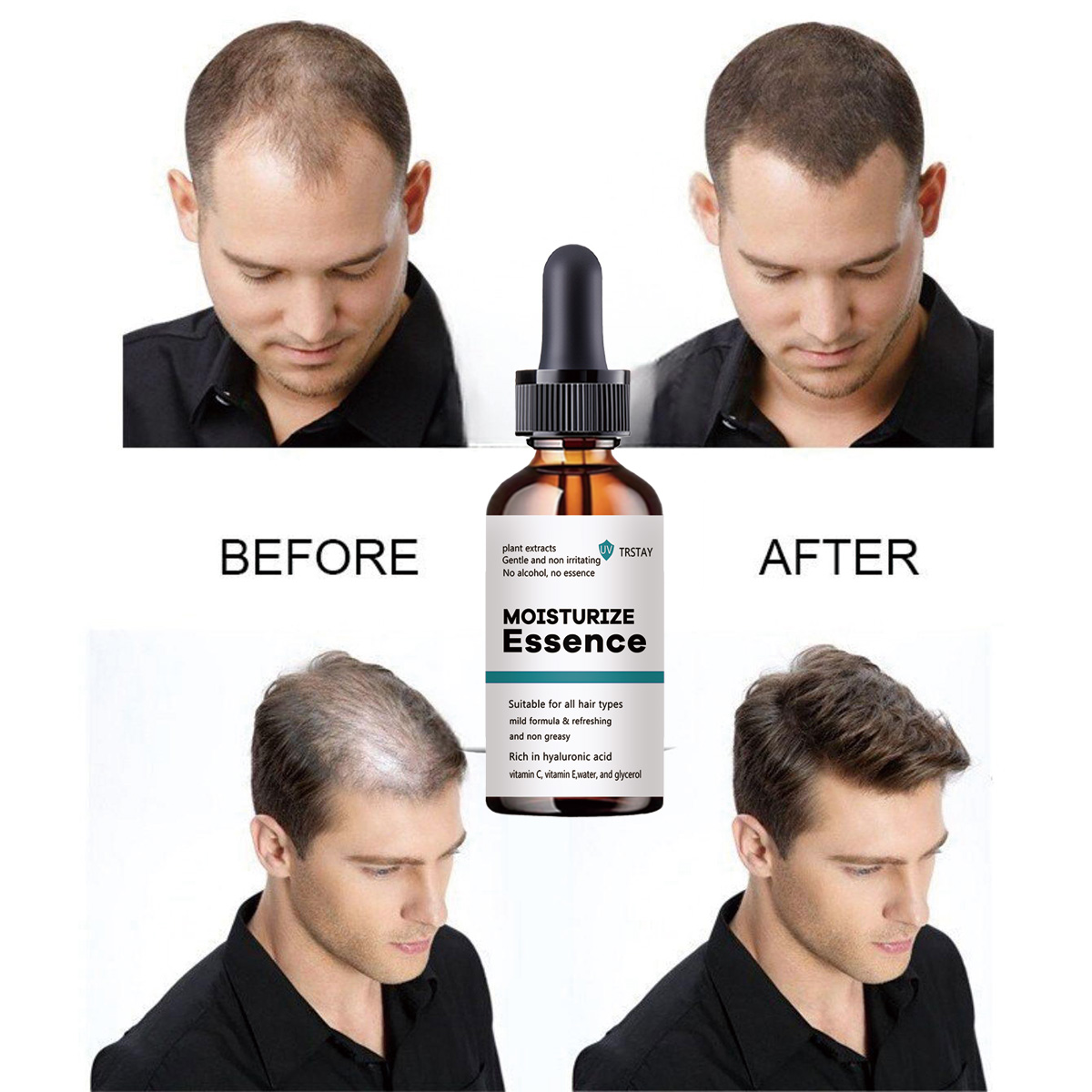 2022 New Hair Growth Essence P - đánh giá và giá Hair Care Ordinary