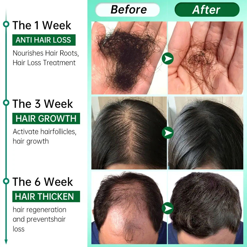 7 Days Fast Grow Hair Growth S - đánh giá và giá Hair Care Essential Oil Atomizing