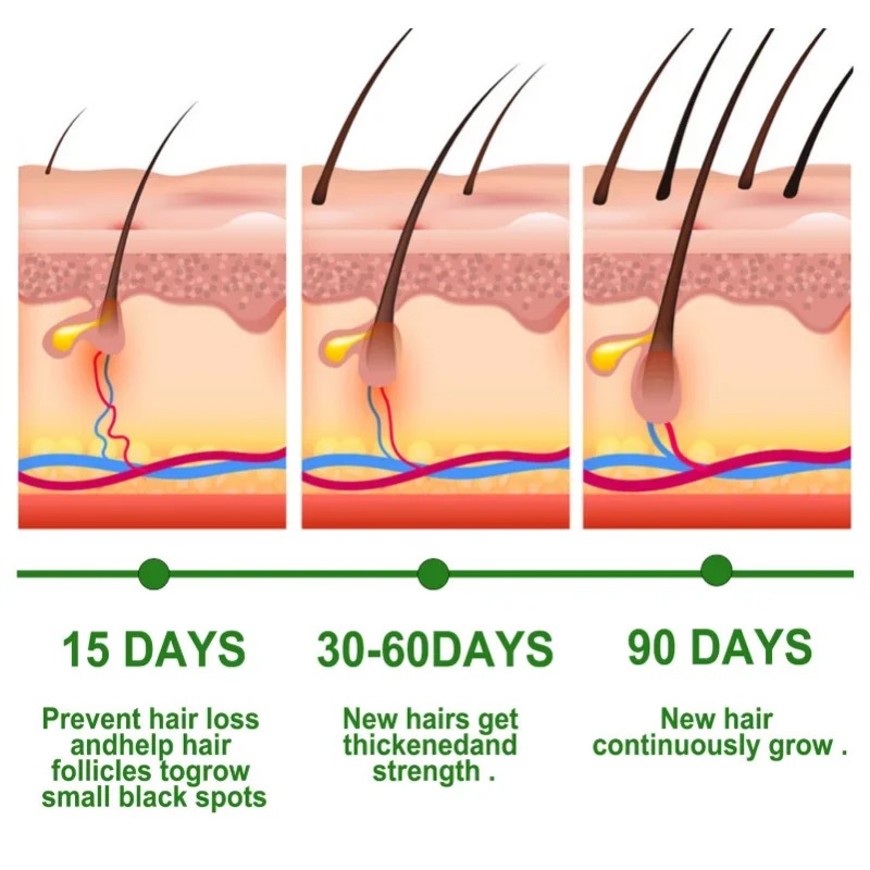 Hair Growth Serum Fast Growing - đánh giá và giá Hair Care Essential Oil Atomizing
