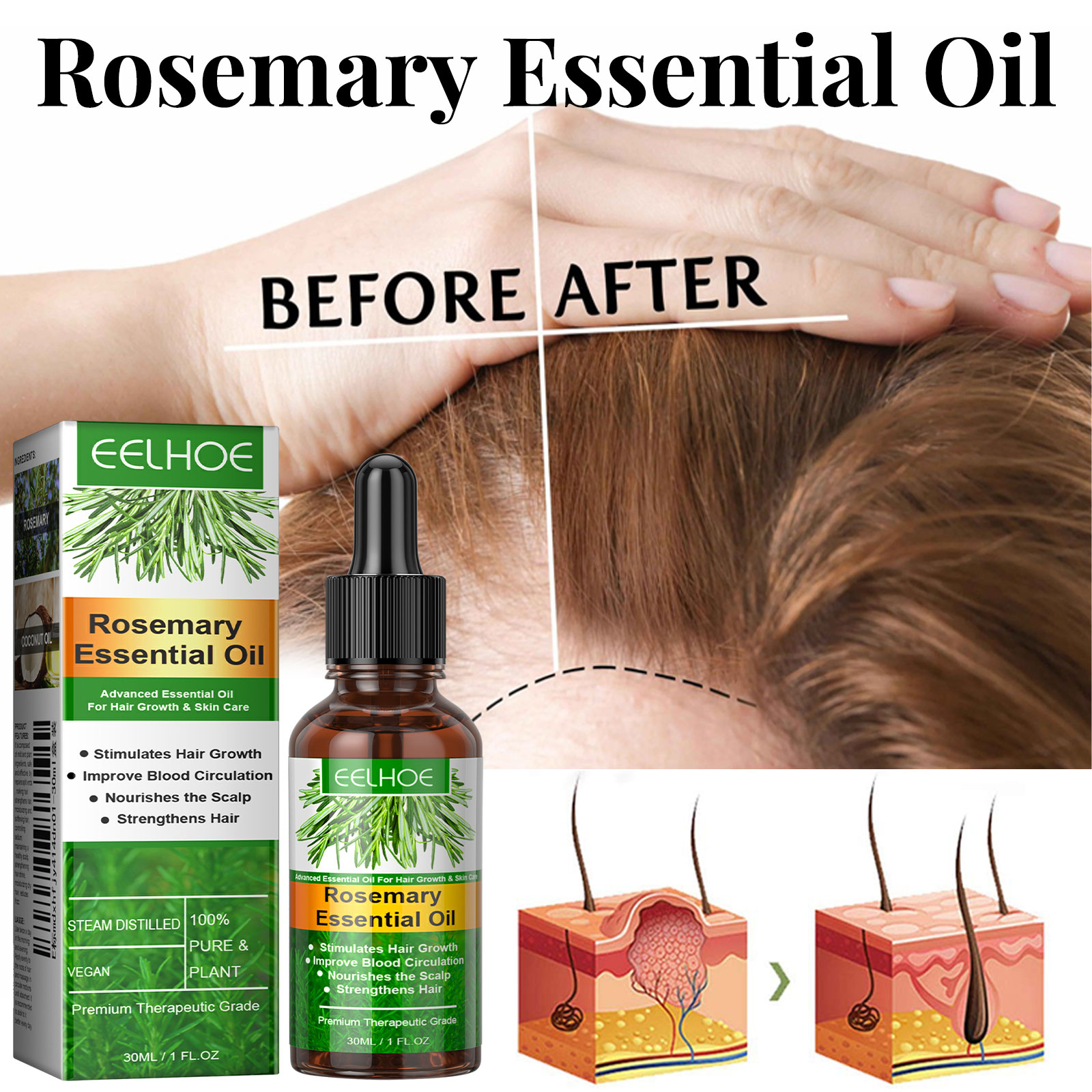 Hair Growth Serum Fast Growing - đánh giá và giá Hair Care Essential Oil Atomizing
