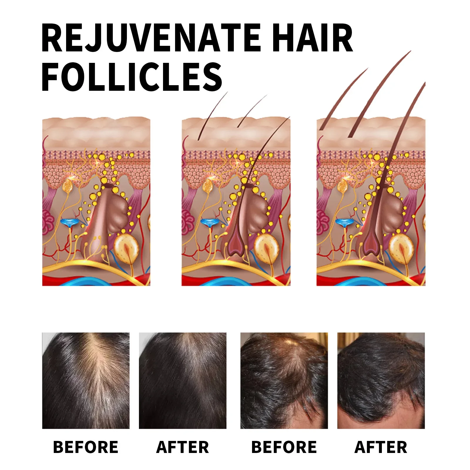 Ginger Hair Growth Products Fa - đánh giá và giá Hair Care Essential Oil Atomizing