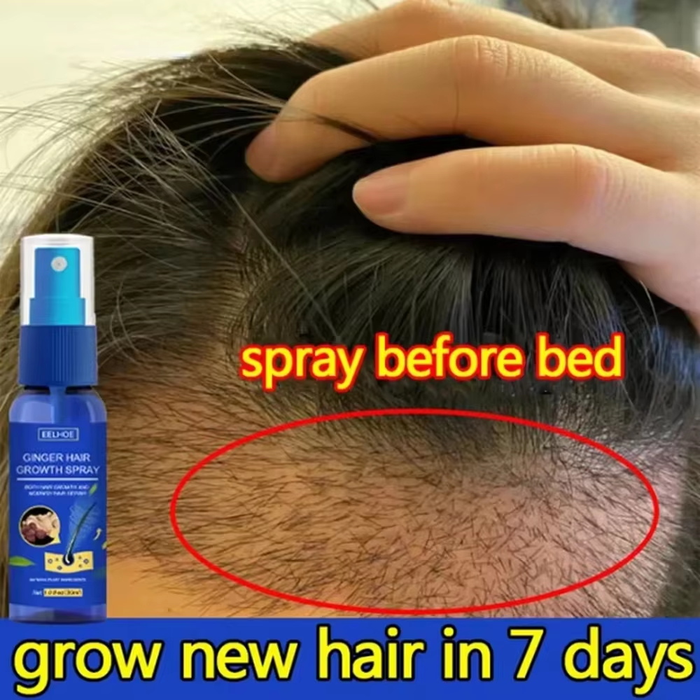 Fast Ginger Hair Growth Spray  - đánh giá và giá Hair Care For Hair Growth