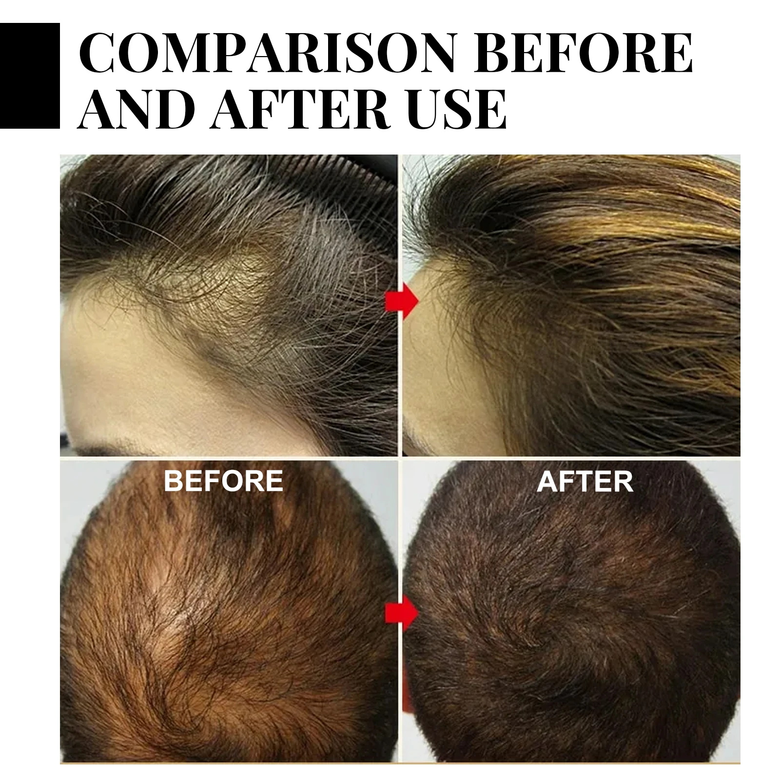 Fast Ginger Hair Growth Spray  - đánh giá và giá Hair Care For Hair Growth