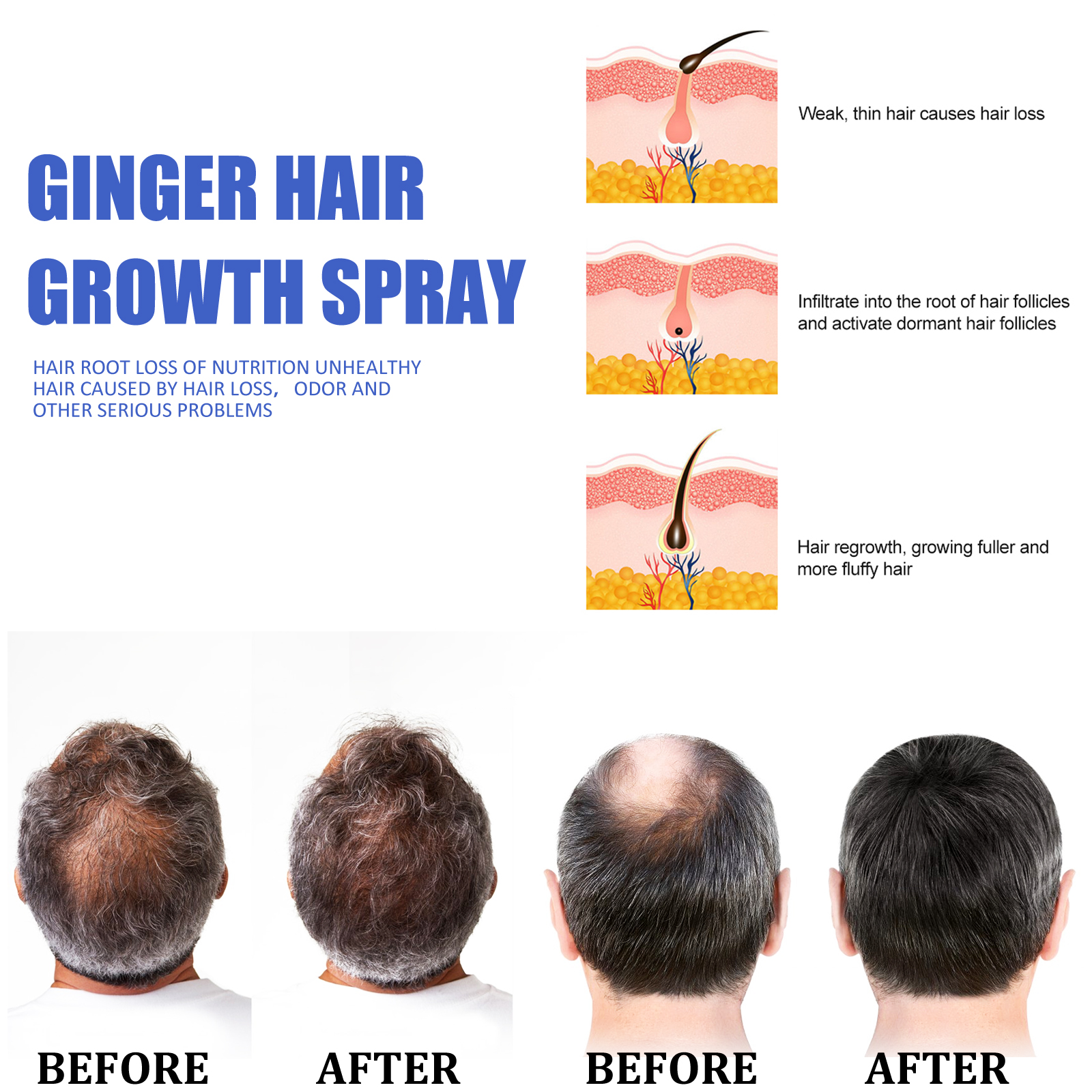 Fast Ginger Hair Growth Spray  - đánh giá và giá Hair Care For Hair Growth