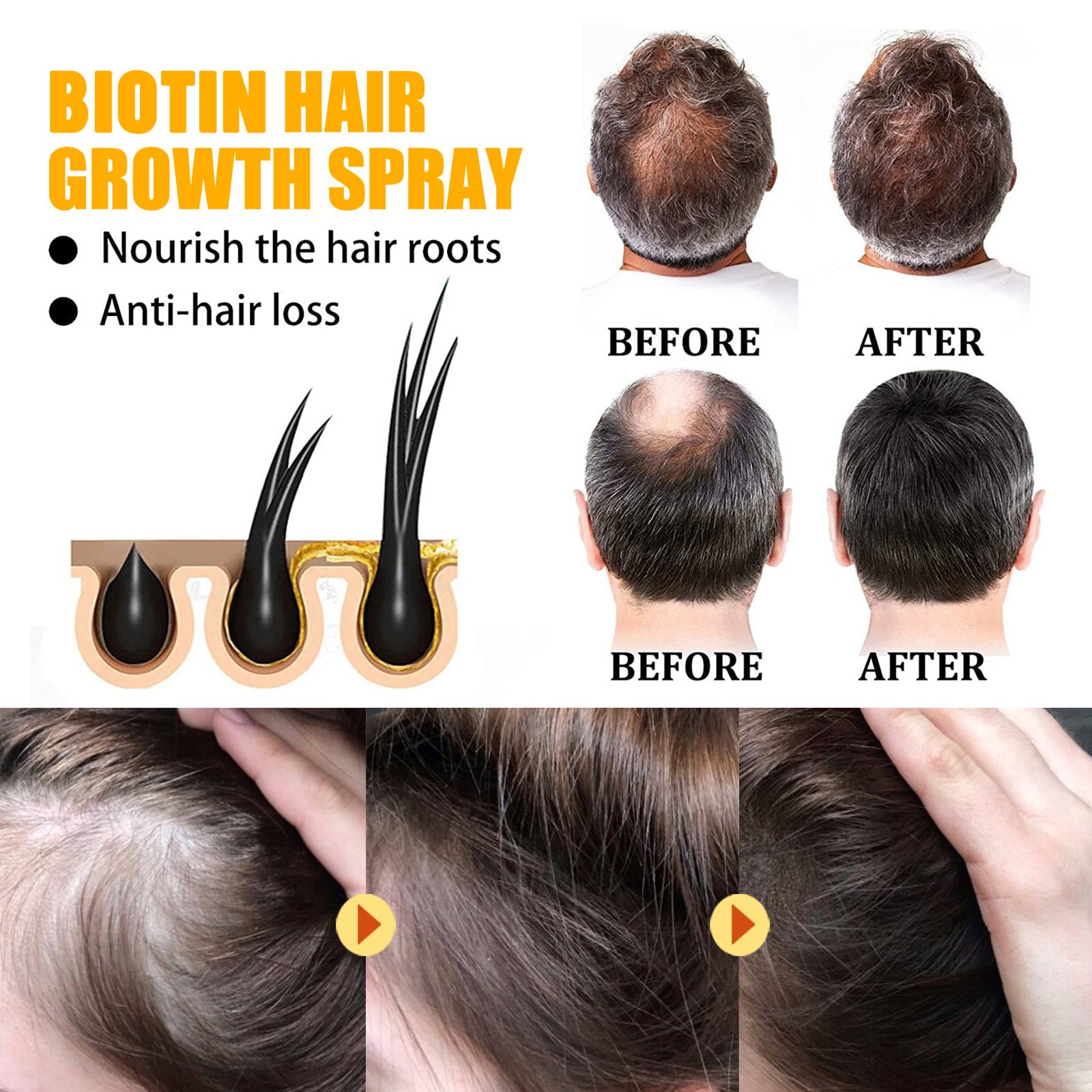 Biotin Hair Care Spray Nourish - đánh giá và giá Hair Care Essence Oil