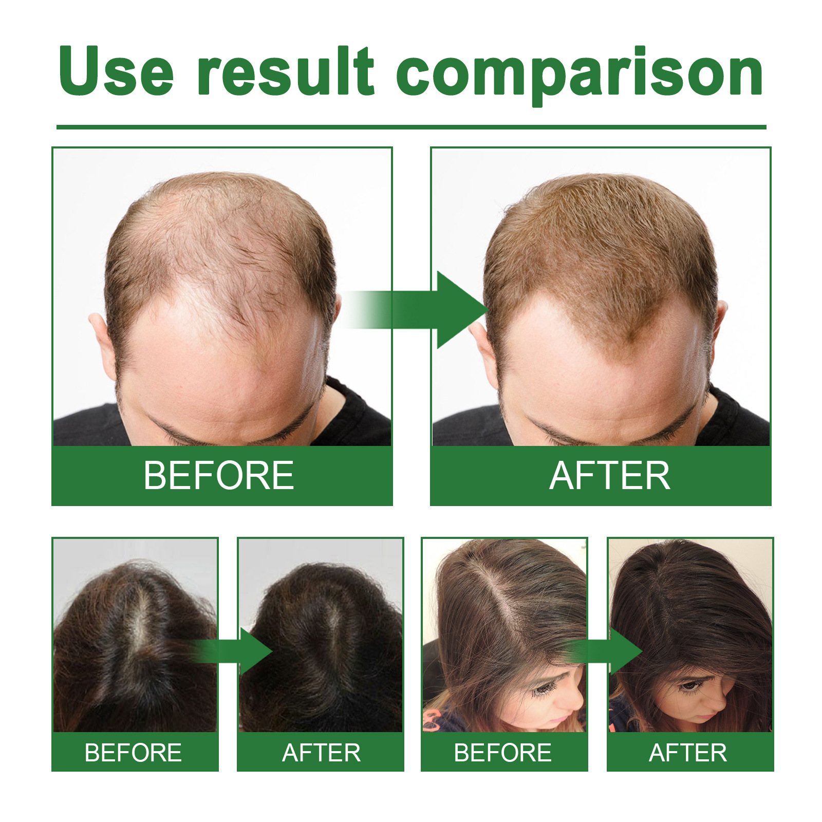 Rosemary Spray for Hair Nouris - đánh giá và giá Hair Care Organic